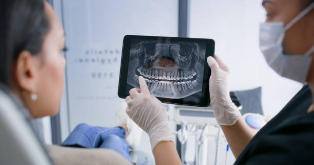 Licensed Root Canal Treatment service in California, PA - Smile Center Dentistry